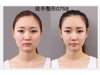 頭痛解消 &nbsp;小顔 根本改善専門店　幸永院　川口店